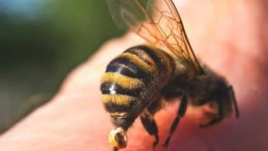 What is the First aid for a bee sting
