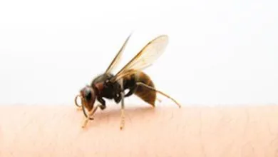 what should you do if a bee stings you?