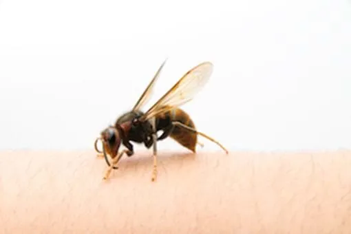 what should you do if a bee stings you?