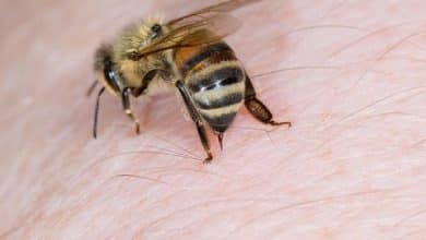 bee stinging skin