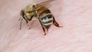 Is bee sting really fatal?