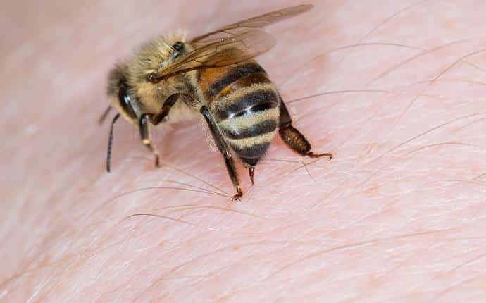 bee stinging skin